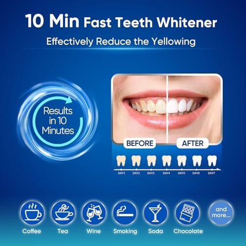 MySmile Teeth Whitening Kit